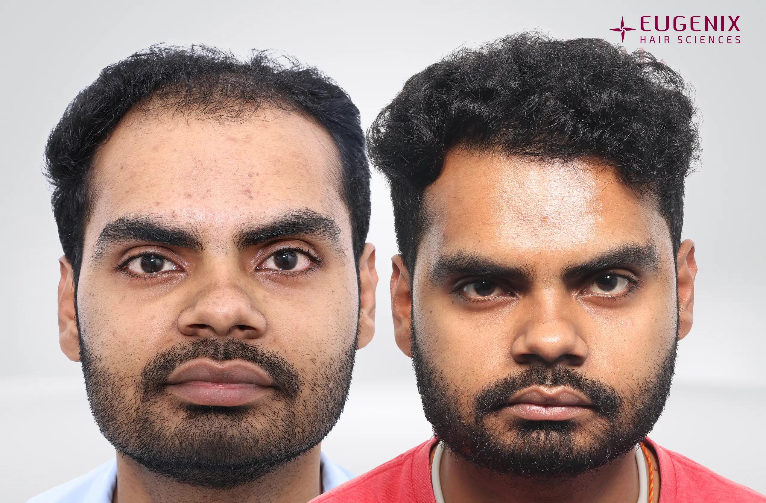 Apporv Jha Before and After Front copy