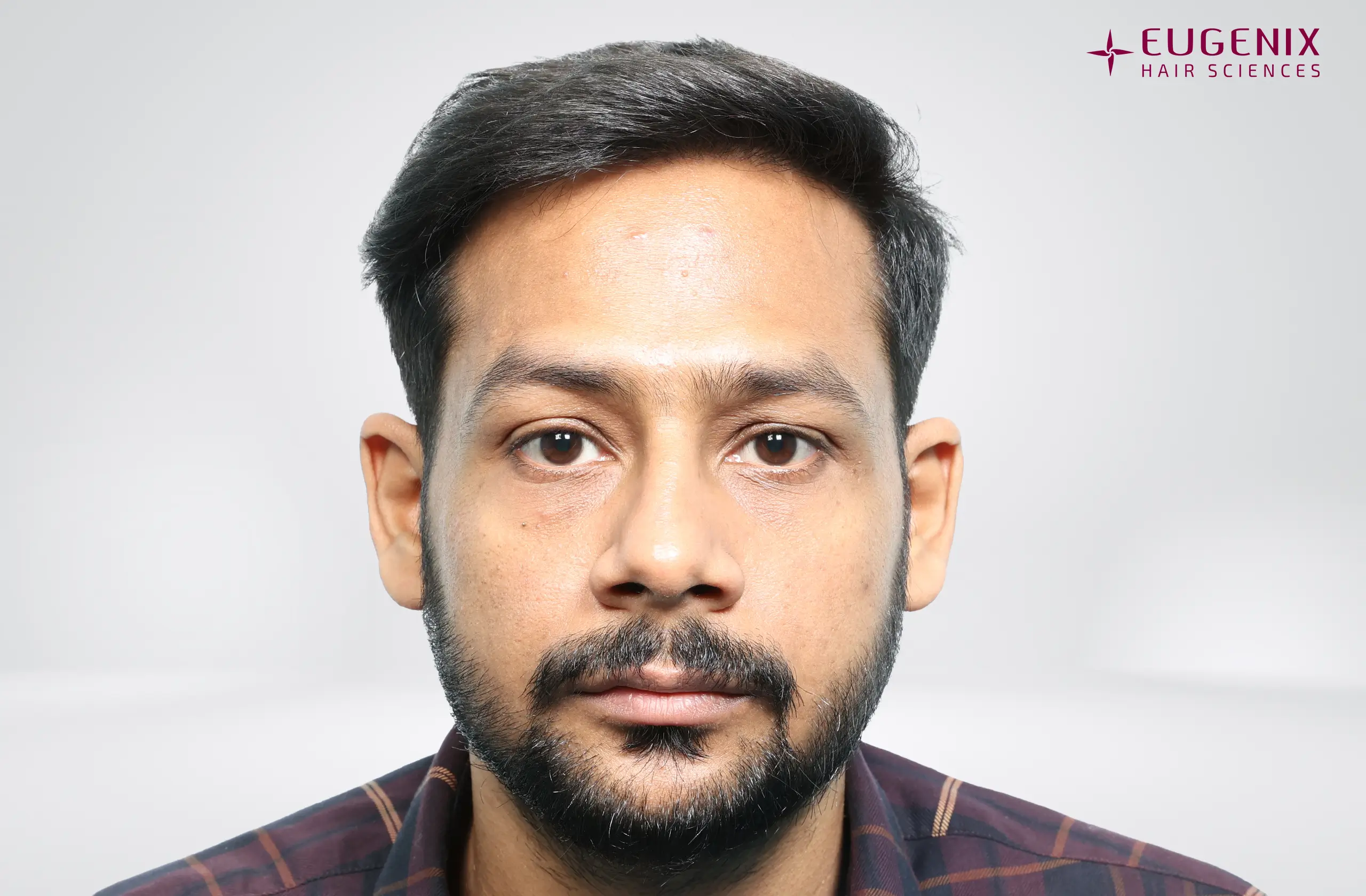 Dr. Akash Kumar After Front copy