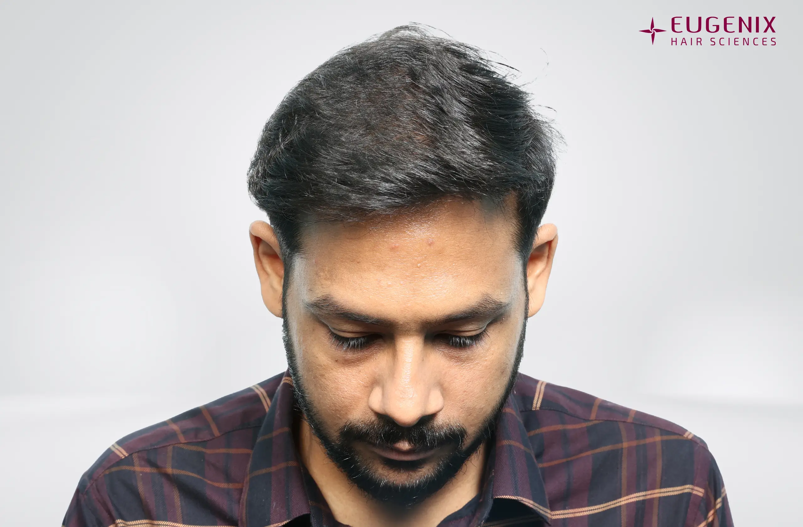 Dr. Akash Kumar After Head Down copy