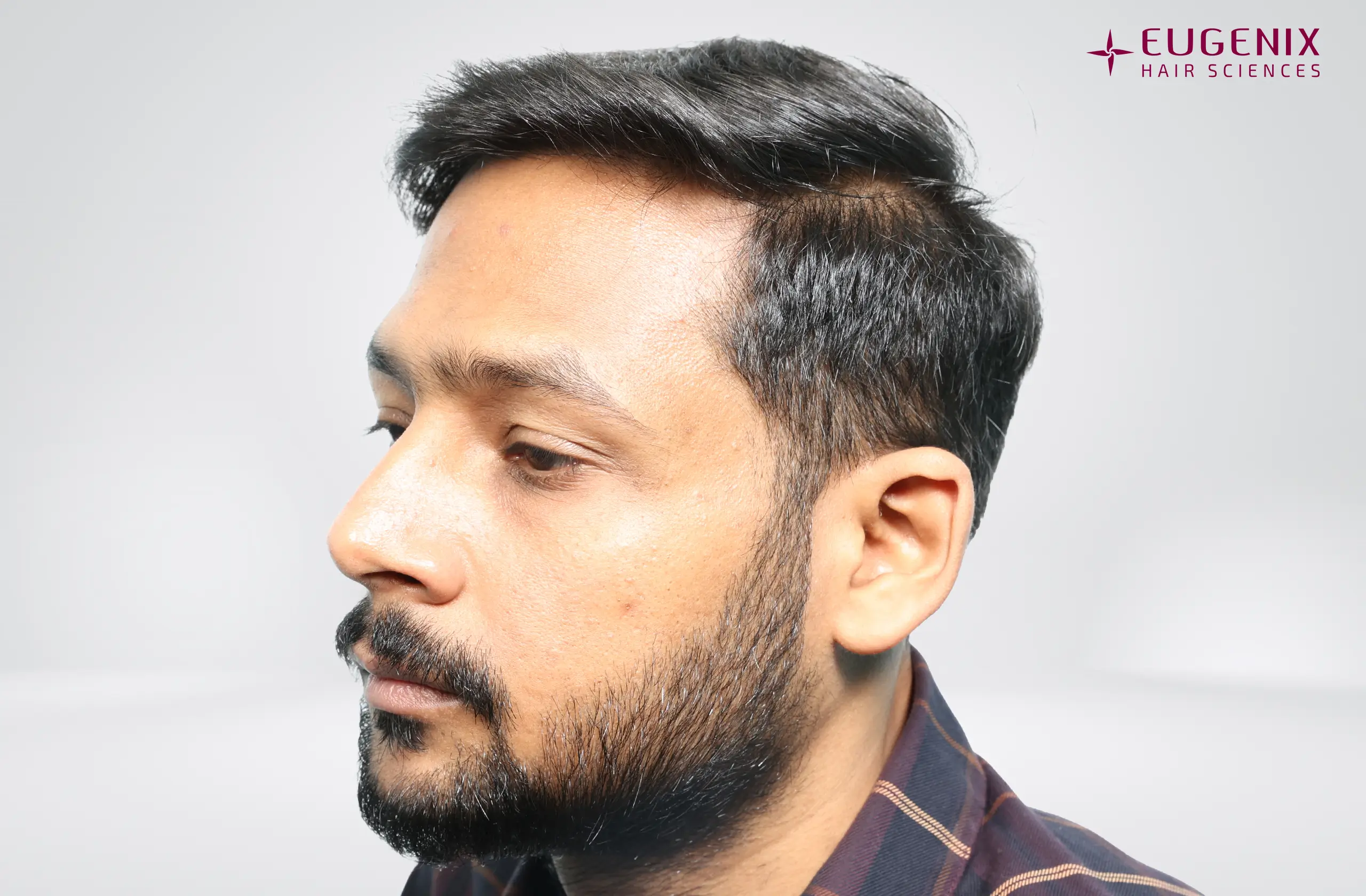 Dr. Akash Kumar After Right copy