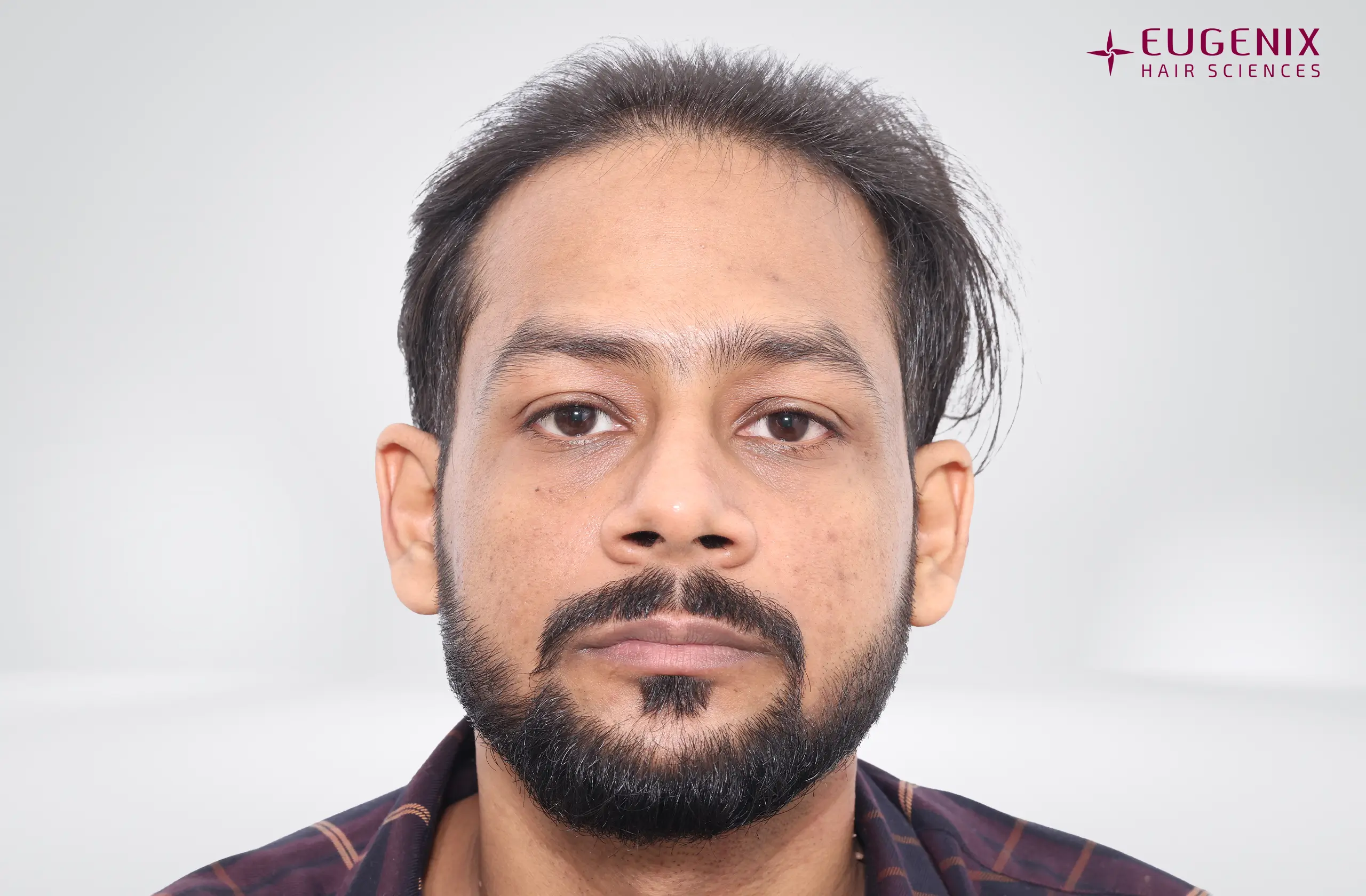 Dr. Akash Kumar Before Front copy