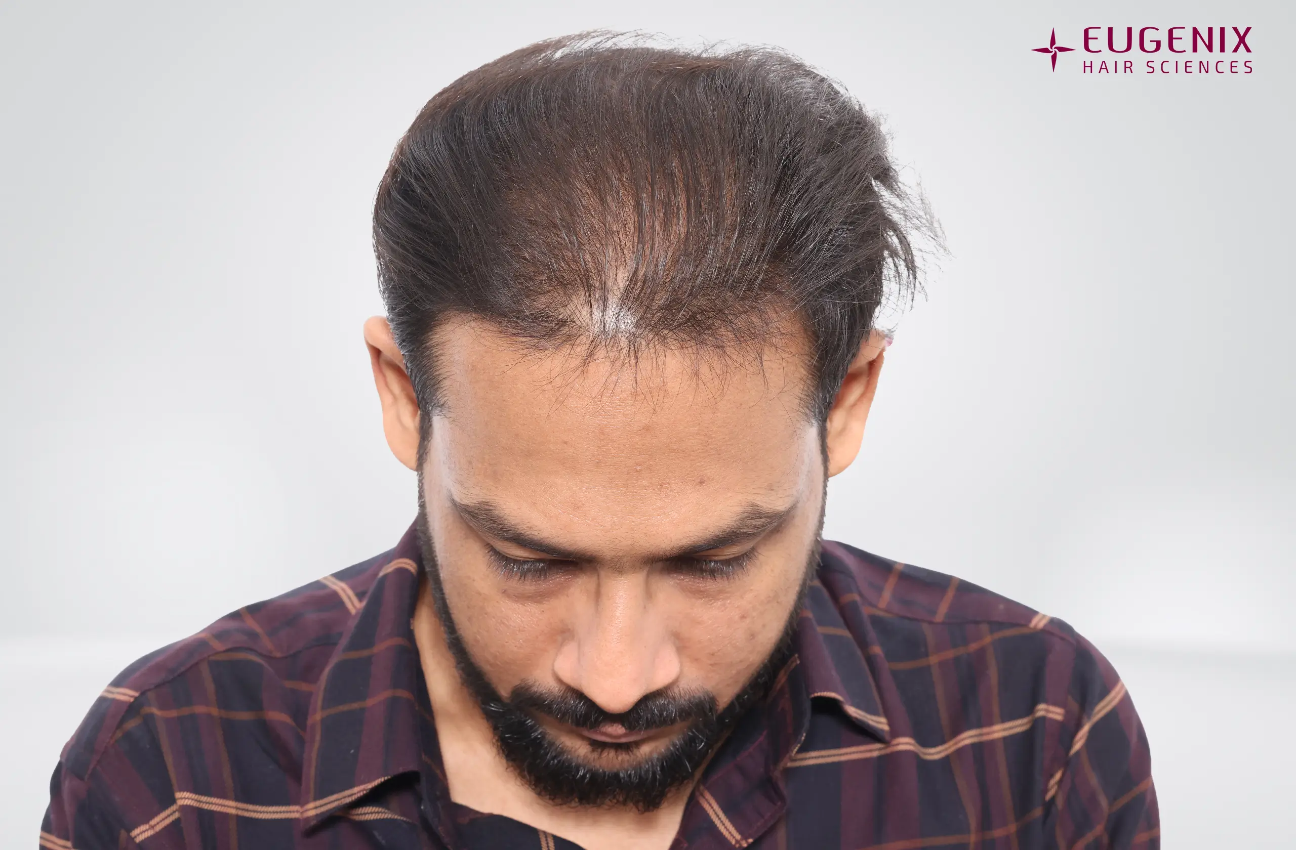 Dr. Akash Kumar Before Head Down copy