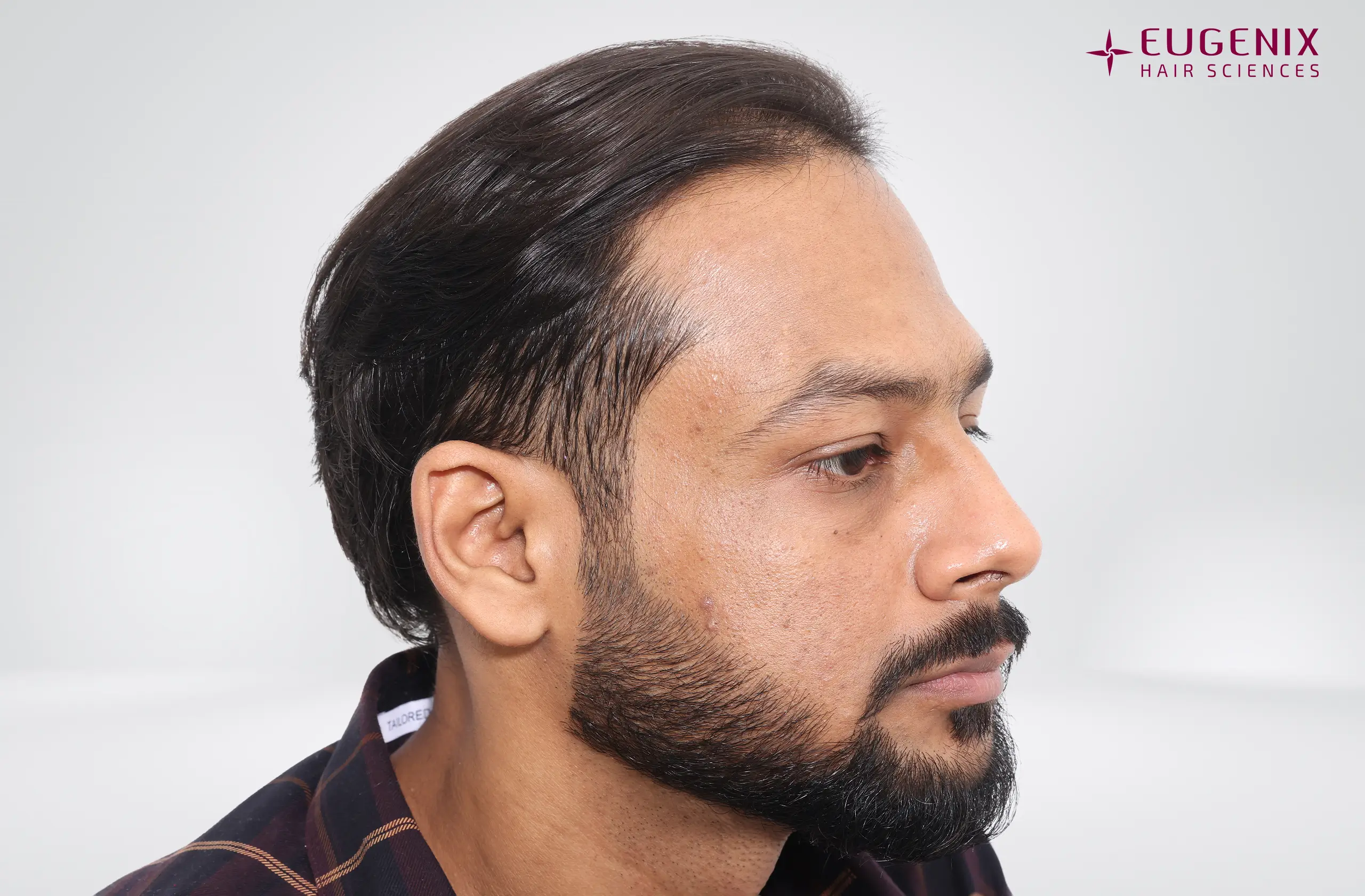 Dr. Akash Kumar Before Left copy