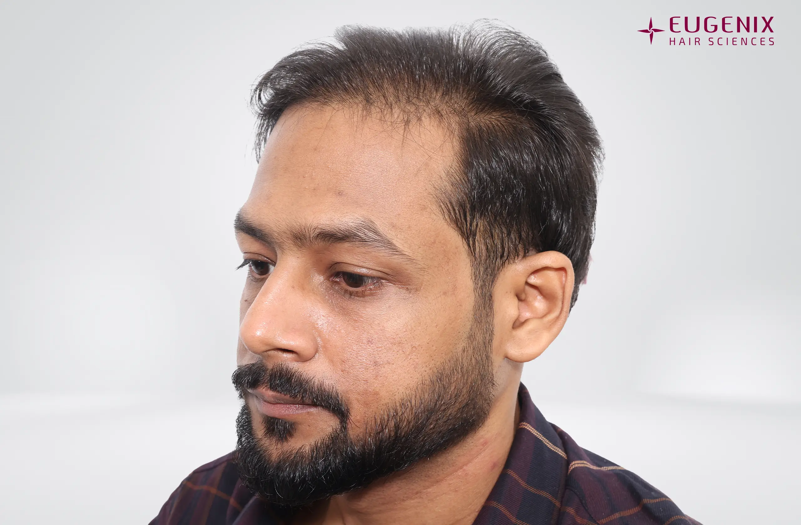 Dr. Akash Kumar Before Right copy