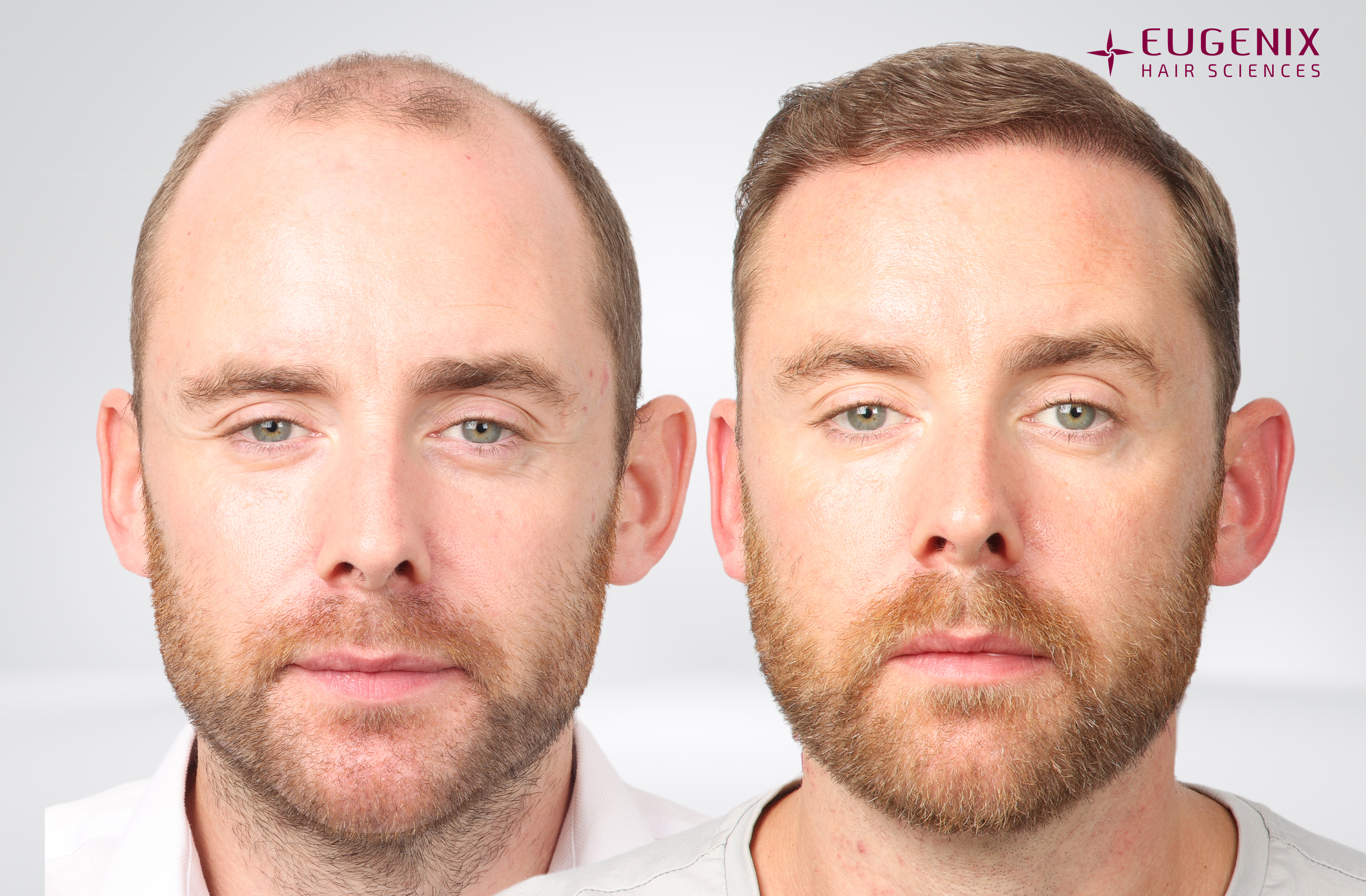 Jamie Scattergood Before and After Front copy