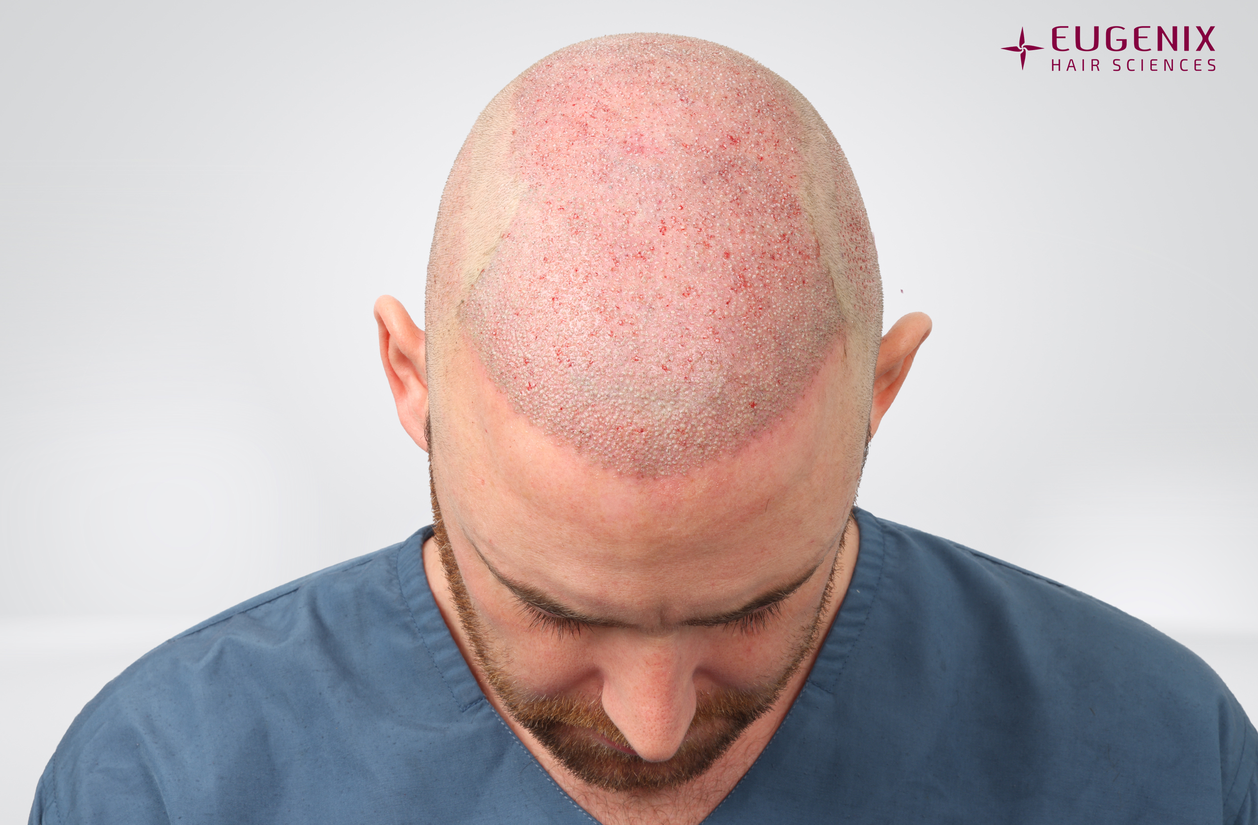 Jamie Scattergood Post-op Head Down copy