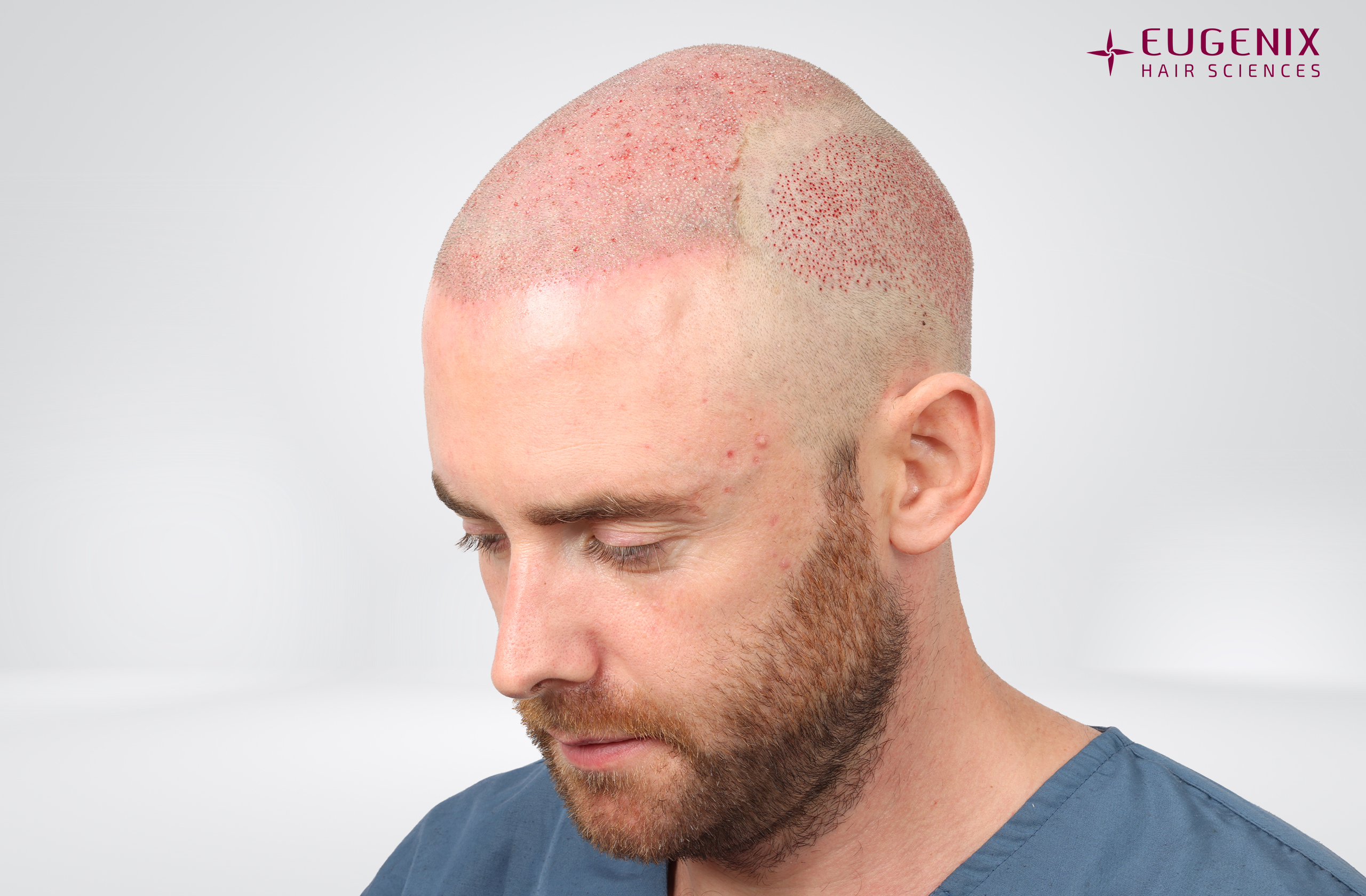Jamie Scattergood Post-op Right copy