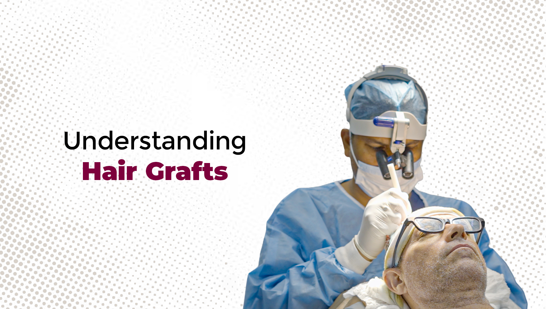 1 Graft How Many Hair? Grafts, Hairs, and Follicular Units Explained