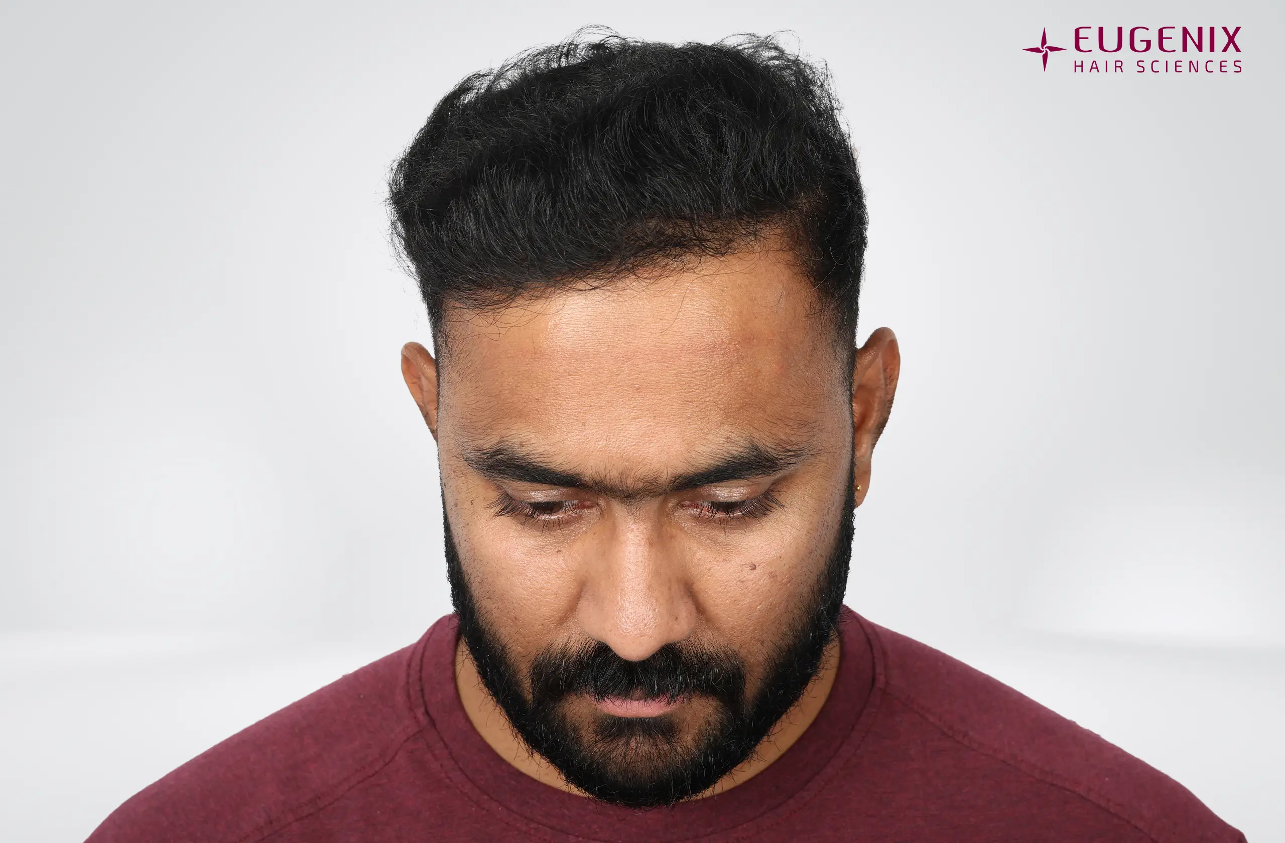 Vineel Jeejula After Head Down copy