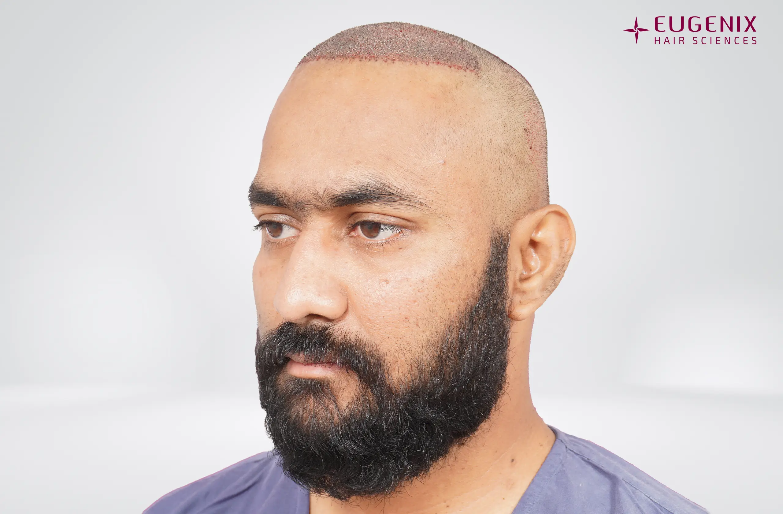 Vineel Jeejula Post-op Right copy