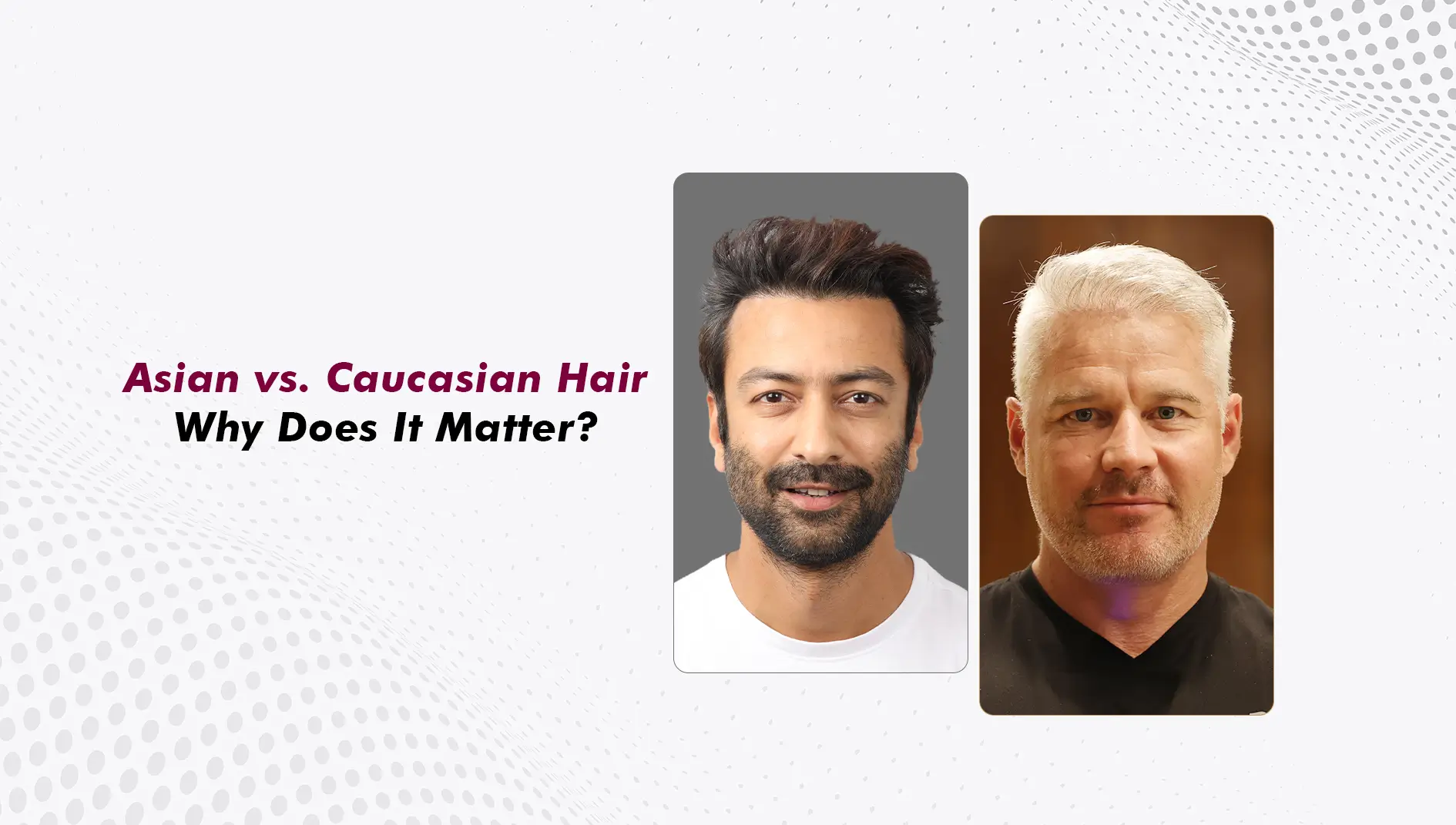 Asian Hair vs Caucasian Hair: How Hair Characteristics Change Hair Transplant Planning