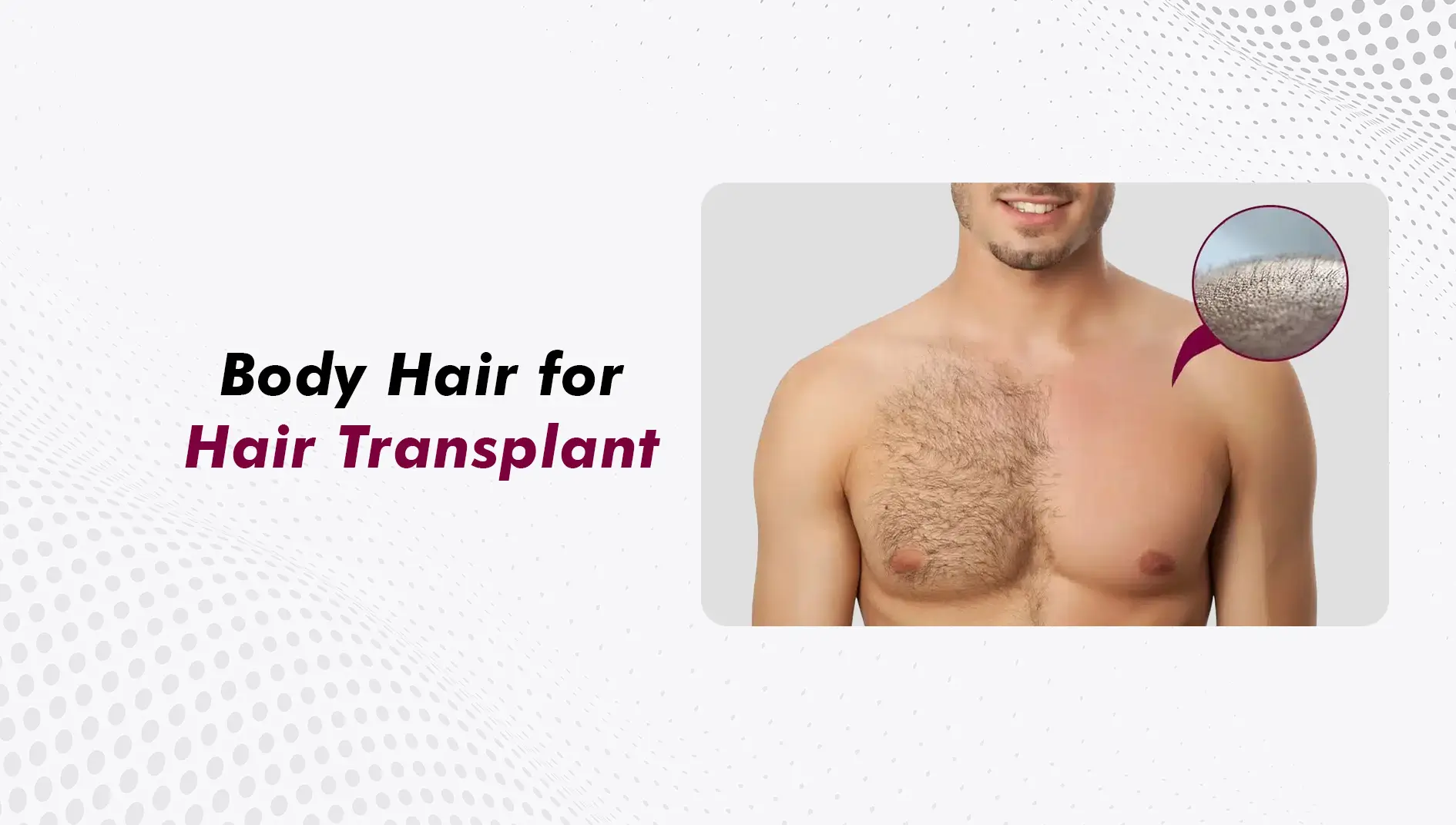 Can Body Hair Be Used for Hair Transplant? What Patients Should Know