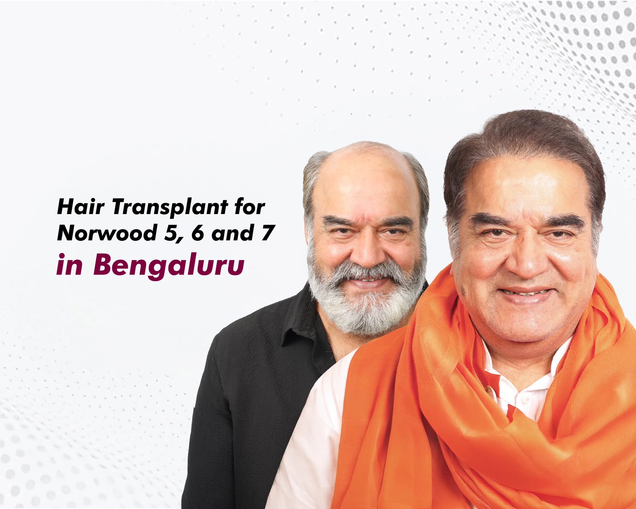Hair-Transplant-5,6,7-Bengaluru copy (2)