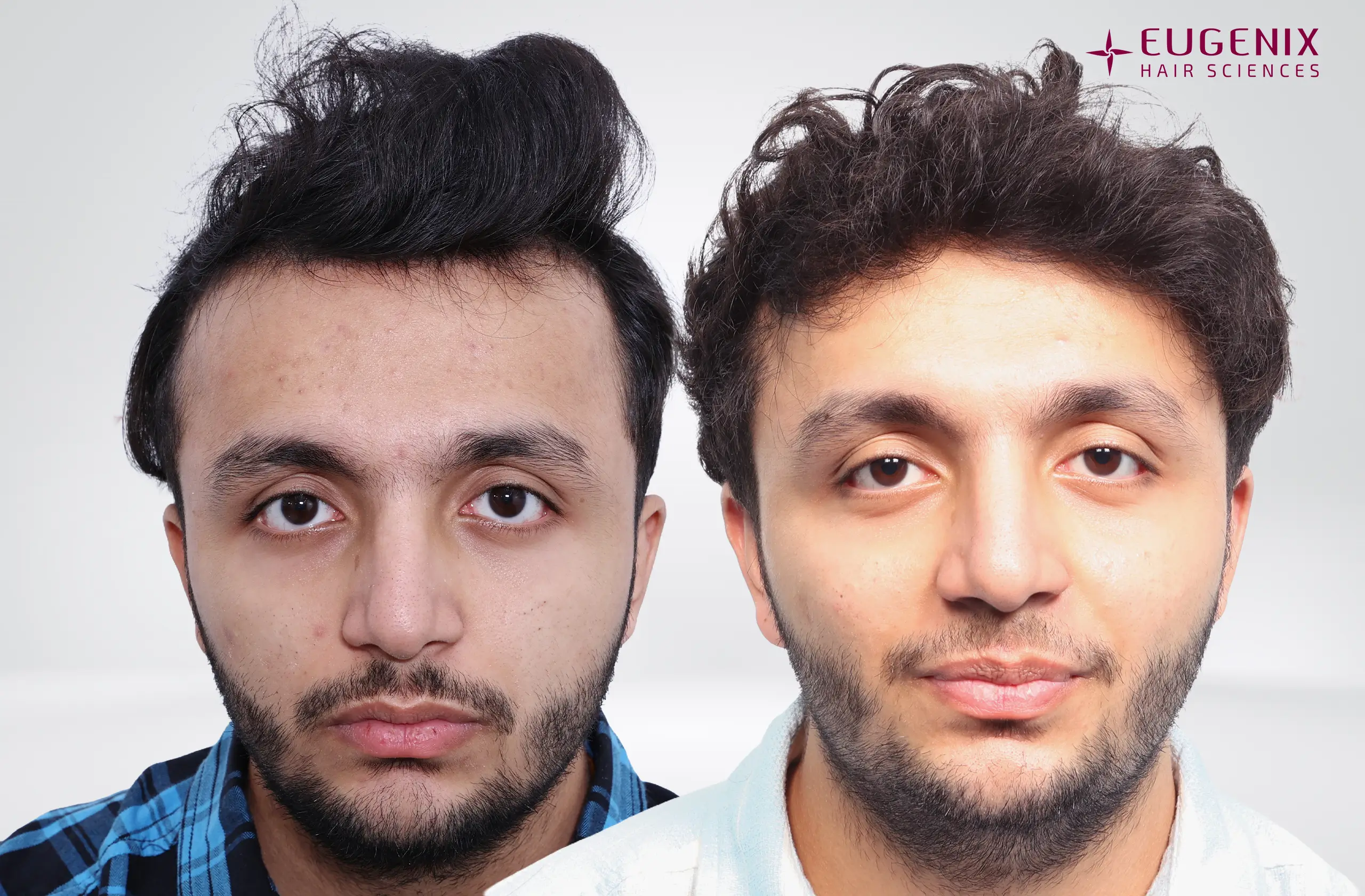 Rohan Before and After Frontt copy