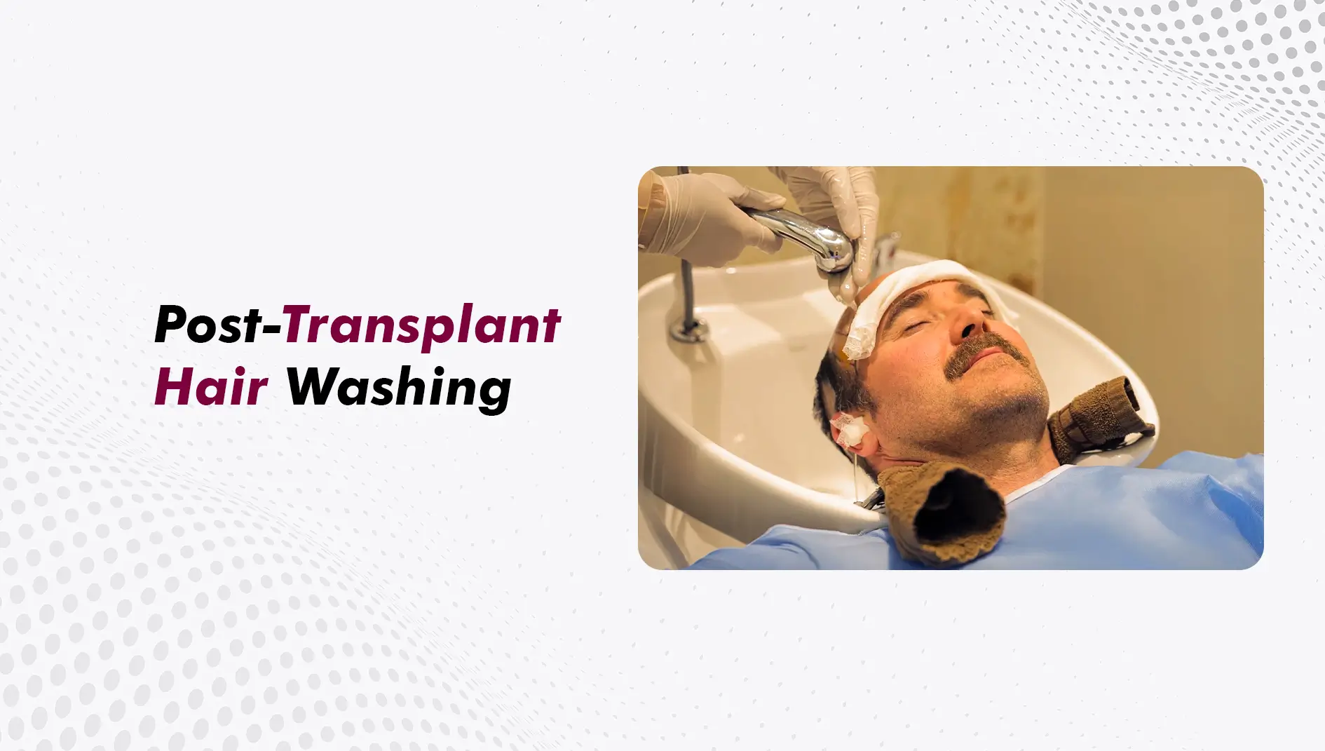 Washing Your Hair After a Hair Transplant: The First 30 Days
